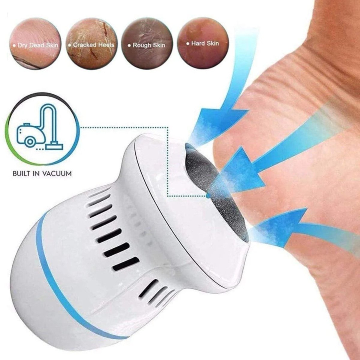 Electric Foot Grinder for Smooth Feet - Electric Foot Grinder - Wild Eye Vision